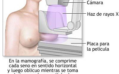 Nuevo golpe a las mamografías