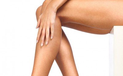 Causas de varices