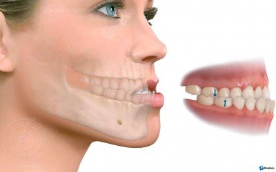 ¿Qué es la Cirugía Maxilofacial y cuándo la necesitas?