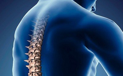 Escoliosis
