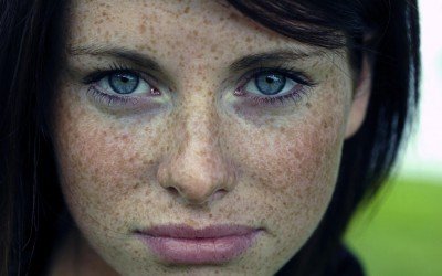 ¿Por que salen las pecas?
