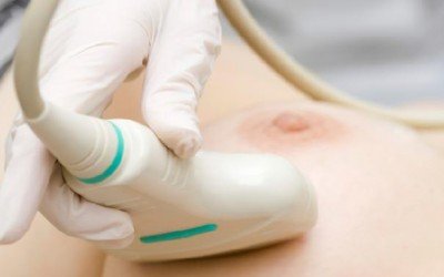 Cómo reconocer los síntomas del cáncer de mama