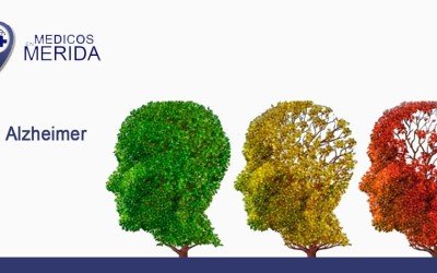 Alzheimer: 10 preguntas para diagnosticar la enfermedad en 5 minutos