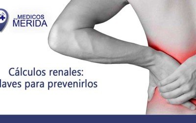 Cálculos renales: claves para prevenirlos