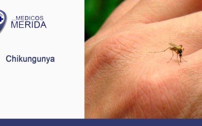 Chikungunya