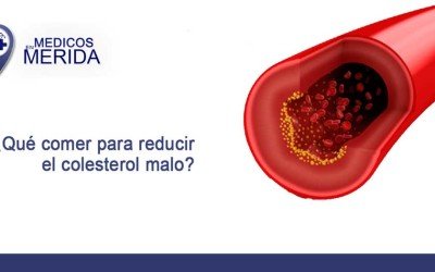 Qué comer para reducir el colesterol malo