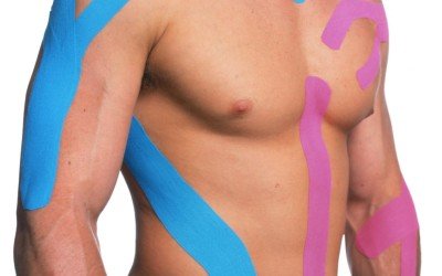 ¿Qué es el popular «kinesio taping» y cómo puede ayudar a tu salud?