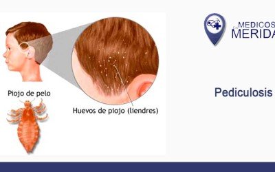 Pediculosis