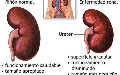 ¿Cuál es la función de los riñones?