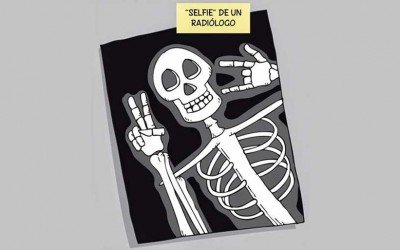 Cuando las radiografías se hacían en zapaterías