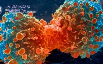 Las 118 cosas que se sabe producen cáncer (y la carne roja no es una de ellas)