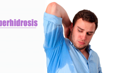 Síntomas y Tratamientos para la Hiperhidrosis