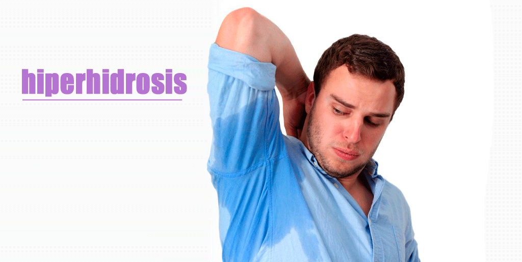 Síntomas y Tratamientos para la Hiperhidrosis