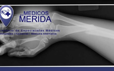 ¿Qué hacer en caso de una fractura?