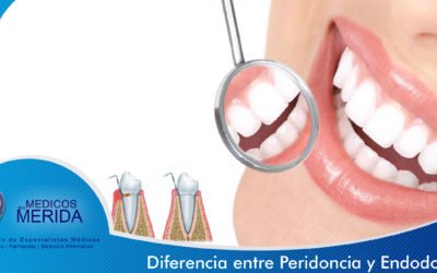 Diferencias entre periodoncia y endodoncia