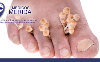 Infecciones micóticas de la piel