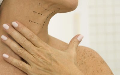 Corrección de cuello