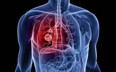 ¿Sabes realmente lo que es el cáncer?