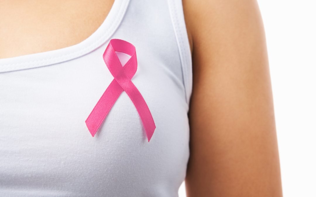 Operaciones para reducir el riesgo de cáncer de mama