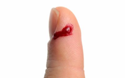 Heridas que podrían ser mortales