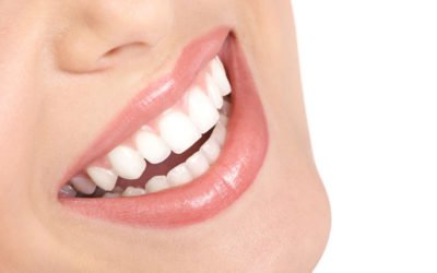 Una dentadura perfecta y espectacular. Todas las estrellas americanas las llevan. Y sus dientes parecen reales.