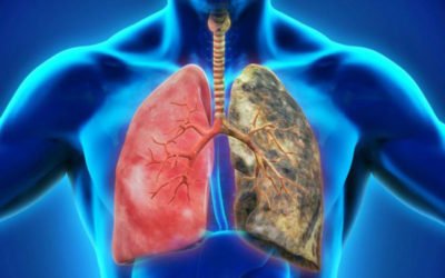 Enfermedad pulmonar obstructiva crónica