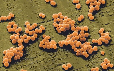 Estafilococo aureurs resistente a meticilina (SARM) o «Superbug»