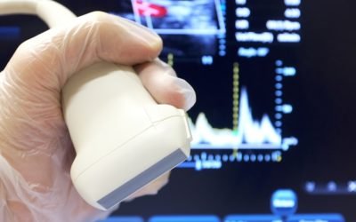 Eco Doppler: cómo se realiza y qué aplicaciones tiene