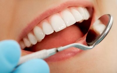 Importancia de la estética dental en México