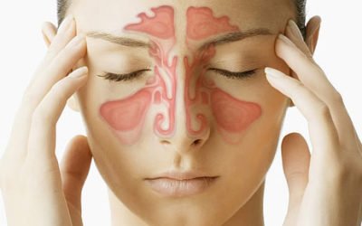 ¿Cuándo es necesario recurrir a la cirugía endoscópica de las vías lagrimales?