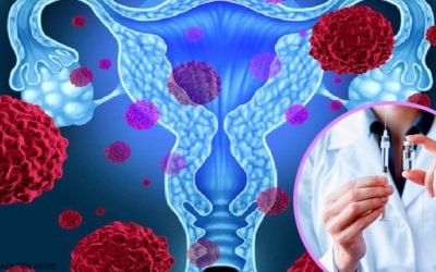 Vacunas contra el virus del papiloma humano para salvar vidas
