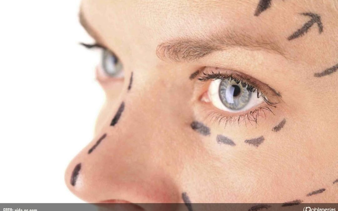 Rinoplastia o cirugÃa de nariz: ¿estética o funcional?