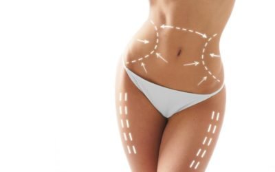 El cuerpo ideal a través de la cirugía estética