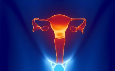 Laparoscopia en el cáncer ginecológico: minimizando riesgos