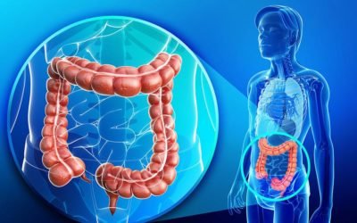 Dieta para eliminación de gases intestinales y des-inflamación del colon
