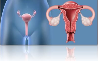 Todo sobre la endometriosis y sus efectos