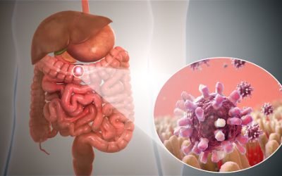 ¿Qué causa la gastroenteritis?