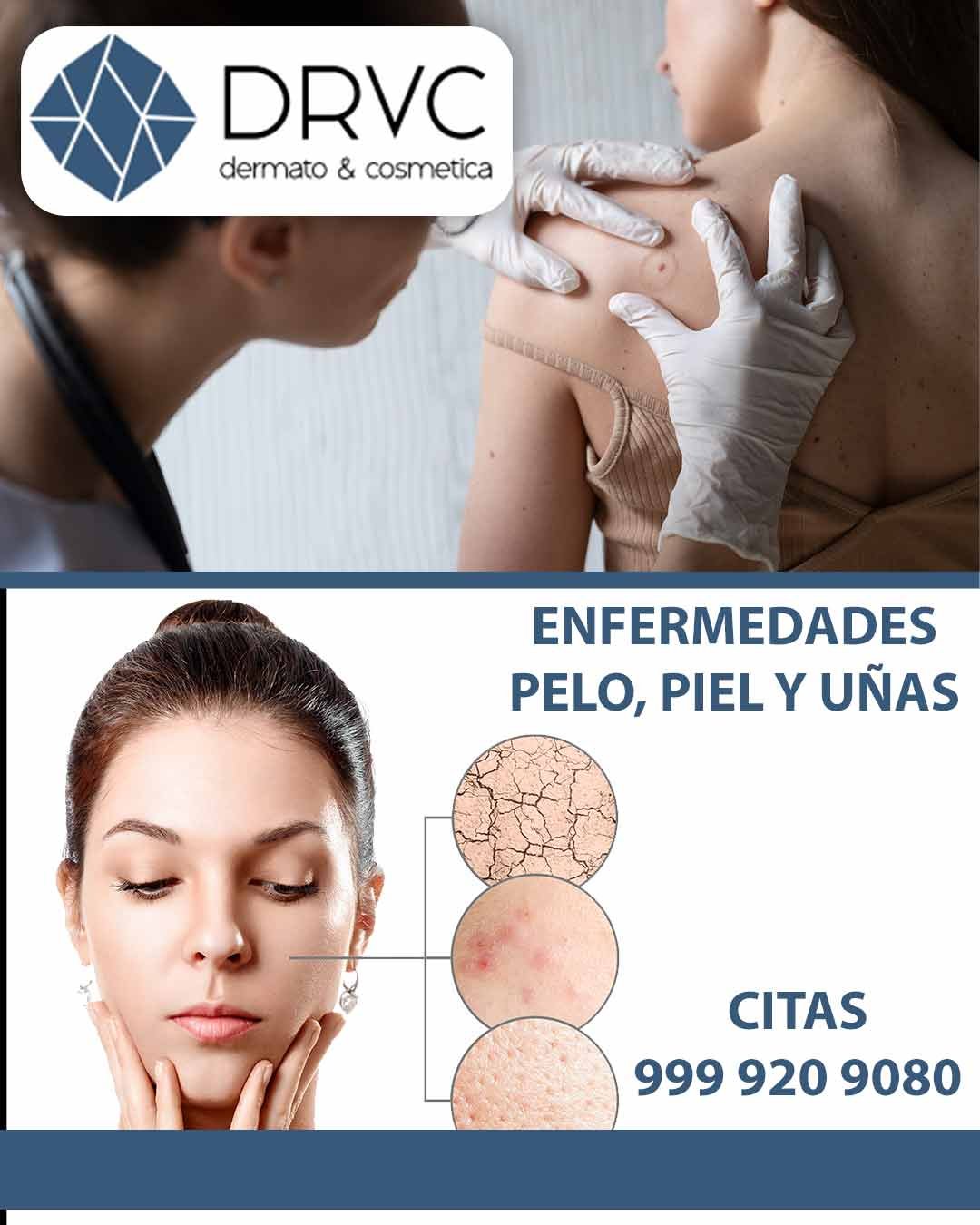 Dermatologo - Dr. Luis Villanueva Casares