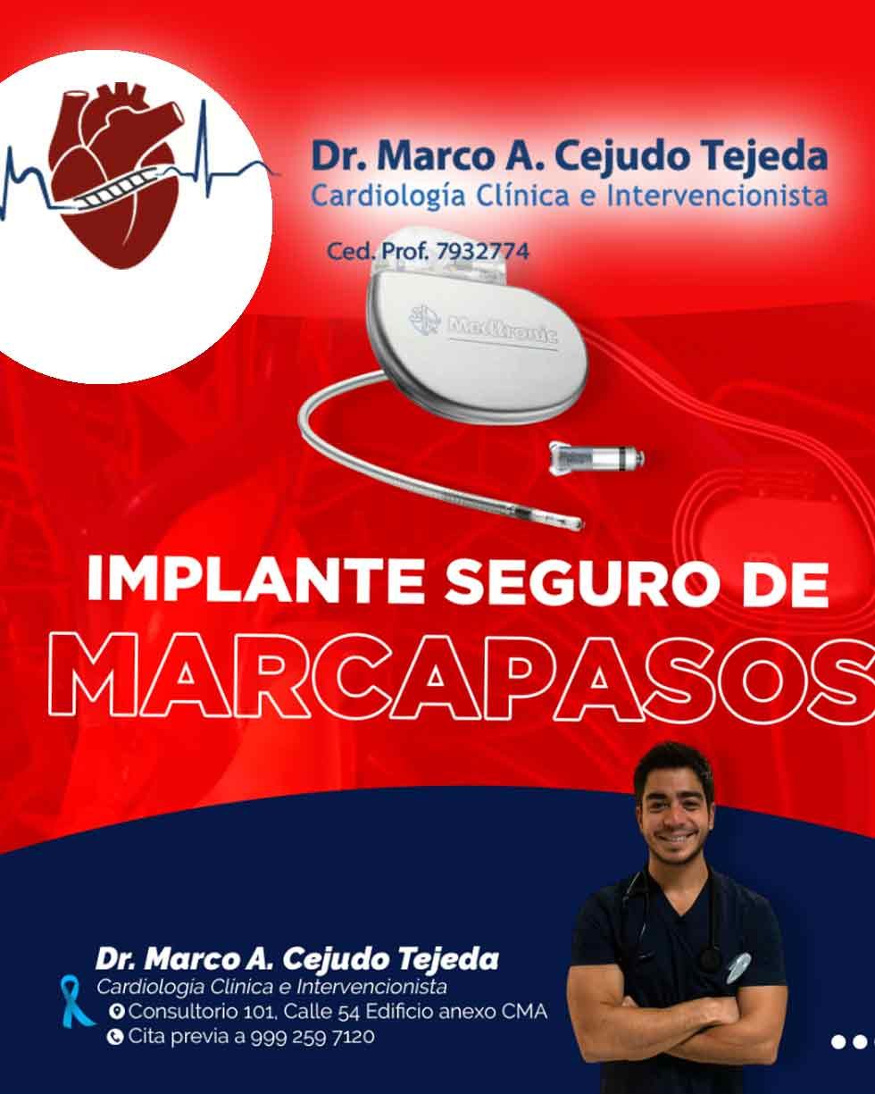 cardio -Dr. cejudo