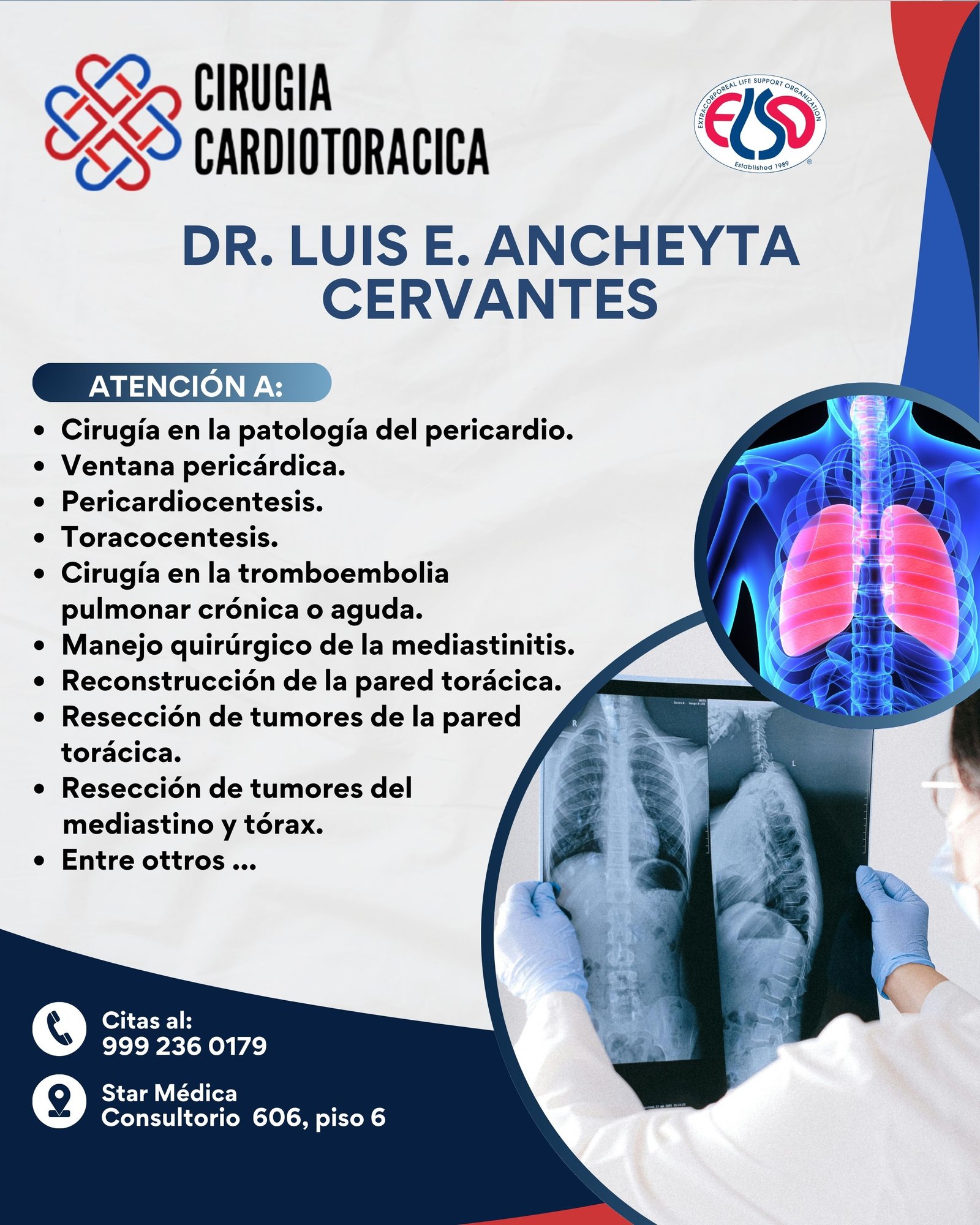 CardioTorax-Dr.Ancheyta