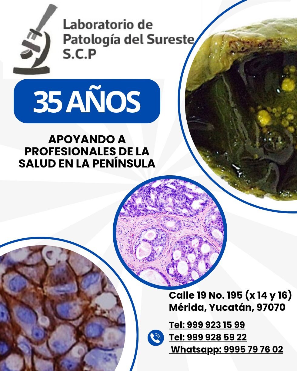 35 años
