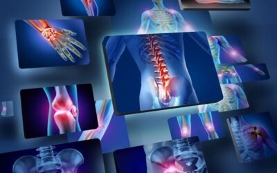 ¿Por qué los algólogos son indispensables hoy en día para el alivio del dolor crónico?