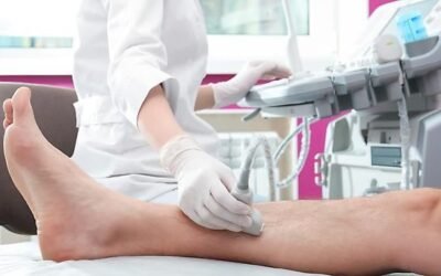¿Por qué la angiología avanzada es la clave para la prevención y el cuidado de tus venas y arterias?