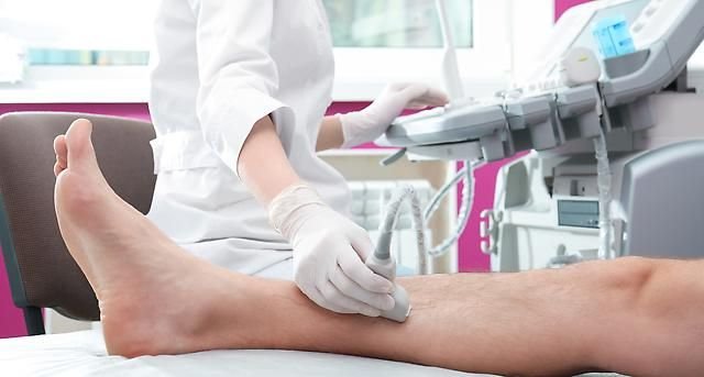 ¿Por qué la angiología avanzada es la clave para la prevención y el cuidado de tus venas y arterias?