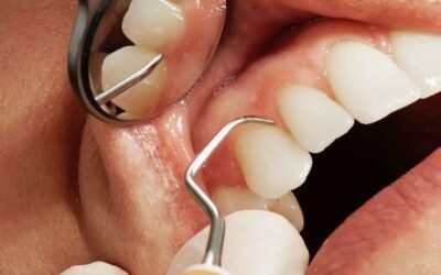 ¿Qué es la regeneración periodontal y cómo ayuda a salvar tus dientes?