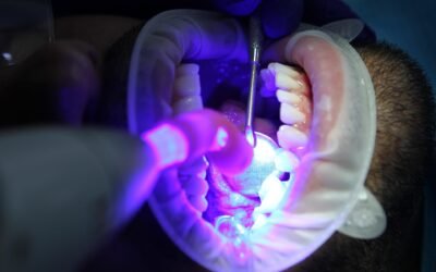 ¿Cuáles son las principales tendencias en estética dental en 2026 para lograr una sonrisa natural?