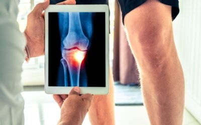¿Cuál es el papel de las terapias biológicas en el control de la autoinmunidad en 2026?